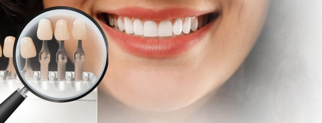 Cosmetic Dentistry San Antonio