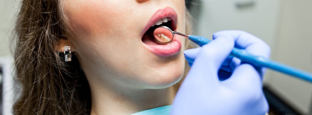 Dental Cleanings San Antonio