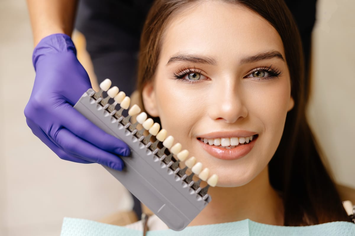 Veneers in Olmos Park