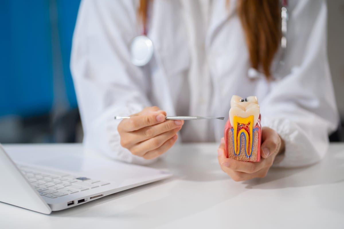 Root Canal Treatment in San Antonio